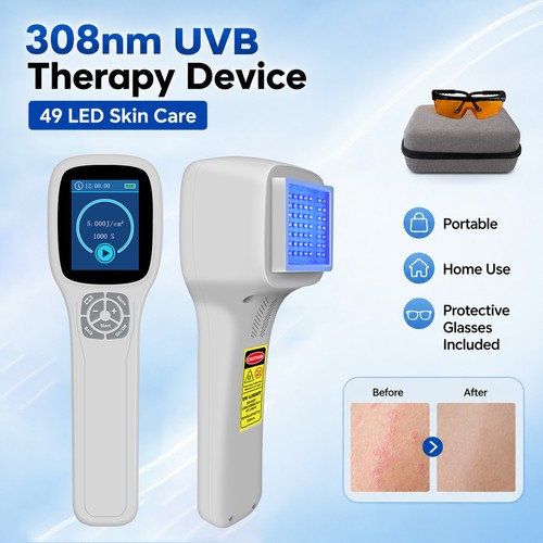 308nm narrowband uvb lamp - narrowband, 49