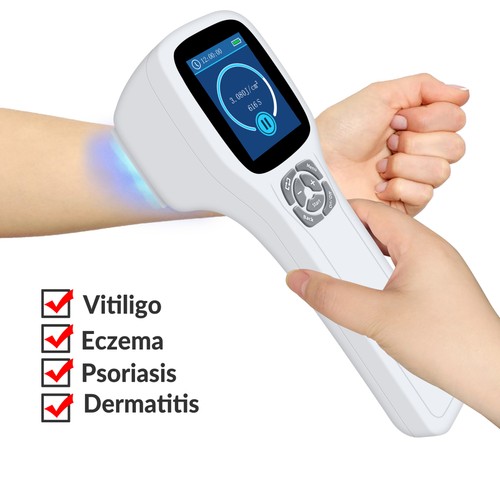 308nm excimer uvb phototherapy - excimer,